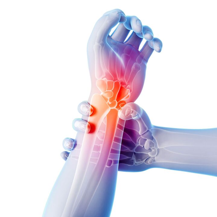 Arthrosis