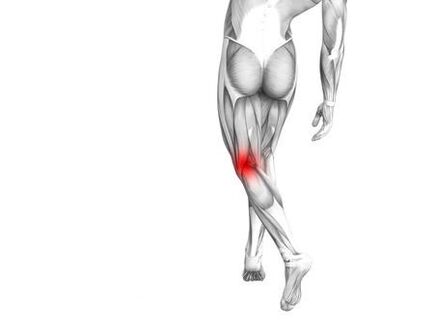 Arthrosis vum Knéi Gelenk