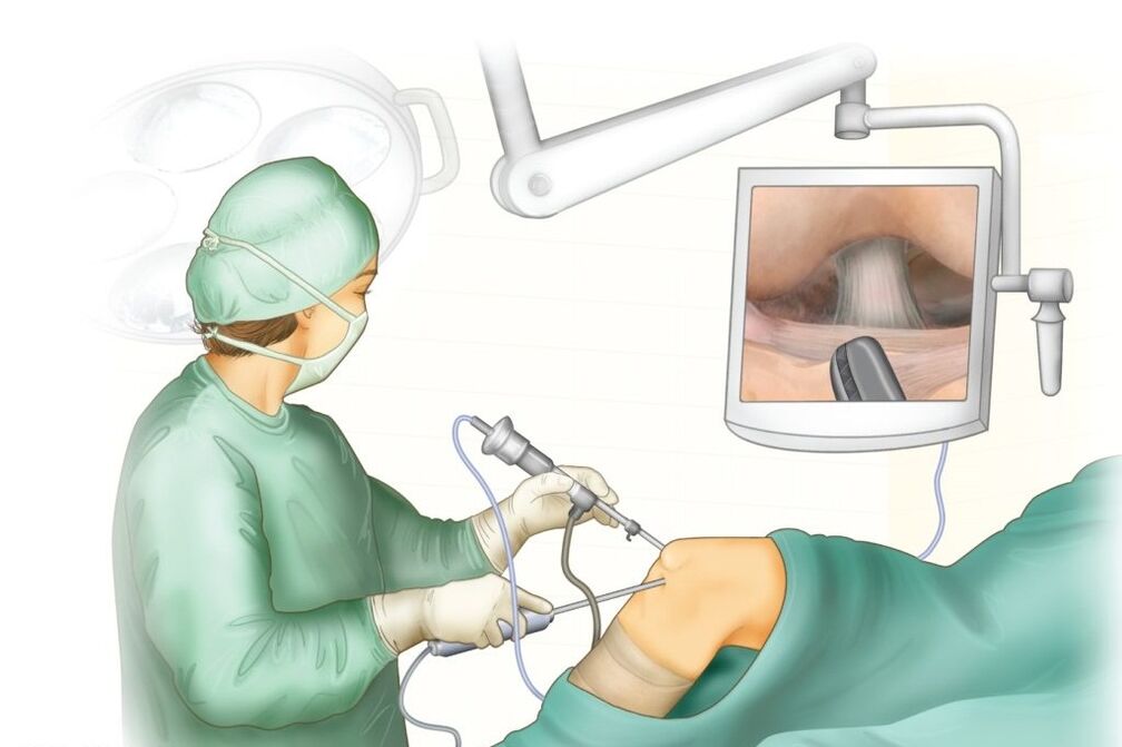 Knie gemeinsam Chirurgie