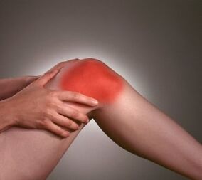 Symptomer vun Arthrosis vum Knéi Gelenk