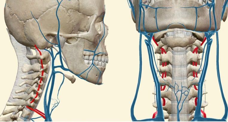 Vaskulär Syndrom zu Osteochendrosis